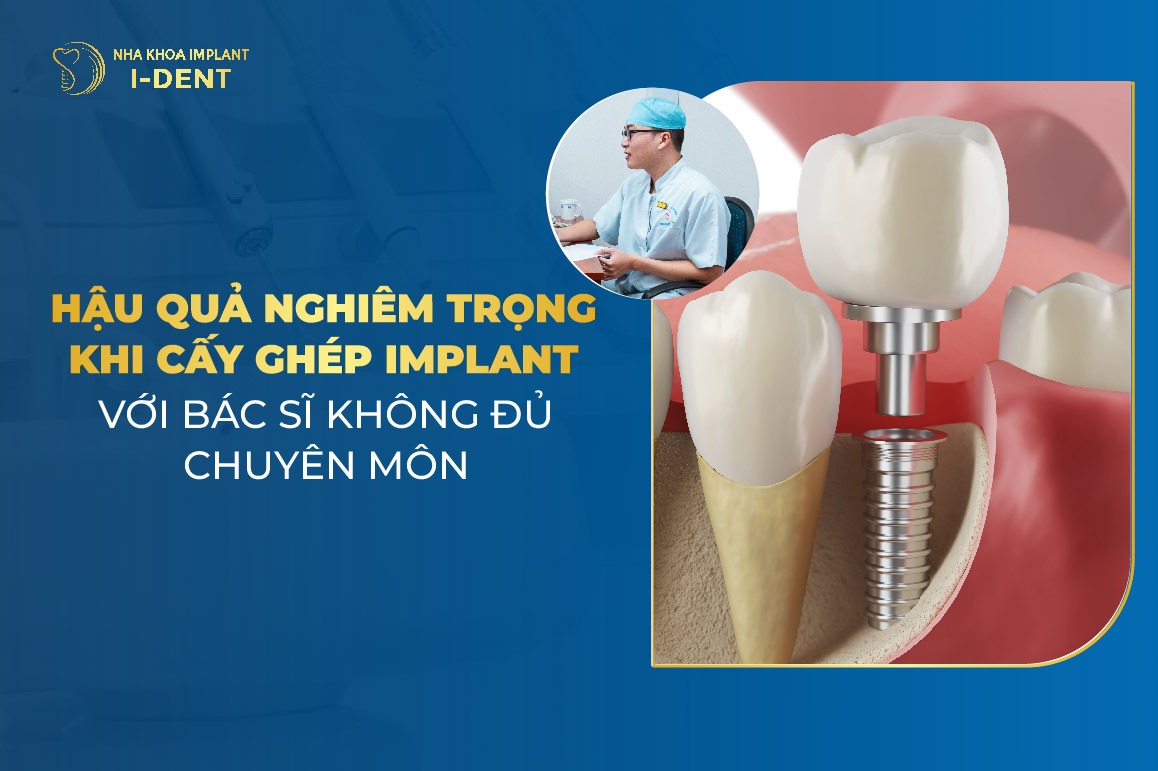 Hau Qua Nghiem Trong Khi Cay Ghep Implant Voi Bac Si Khong Du Chuyen Mon