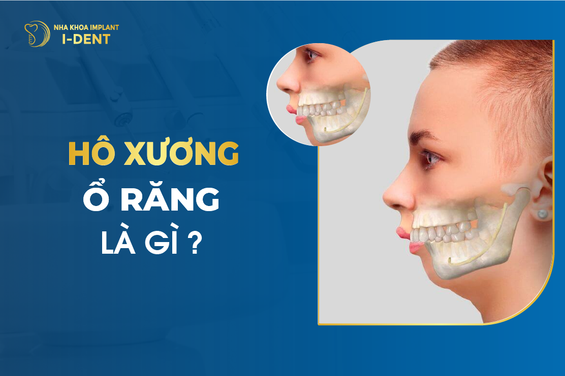 Ho Xuong O Rang La Gi