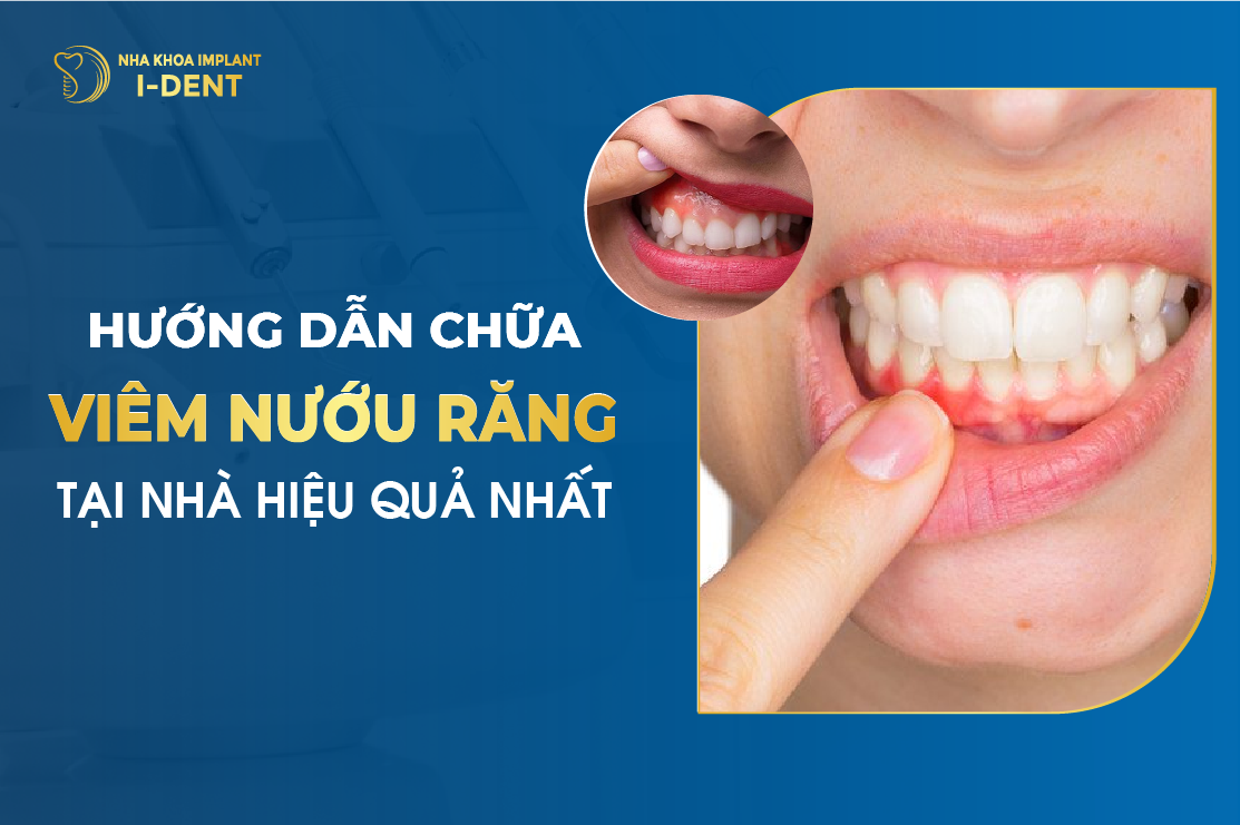 Huong Dan Cach Chua Viem Nuou Rang Tai Nha Hieu Qua Nhat