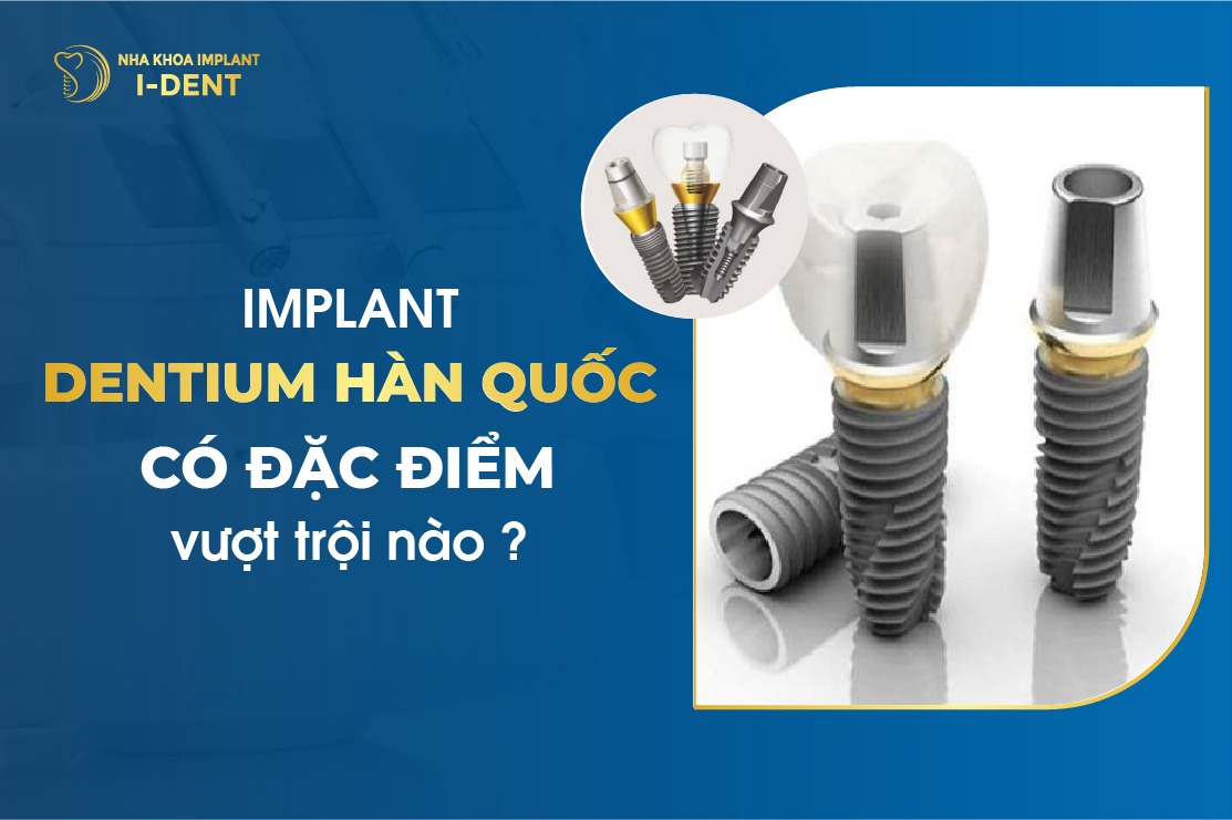 Implant Dentium Han Quoc Co Dac Diem Vuot Troi Nao