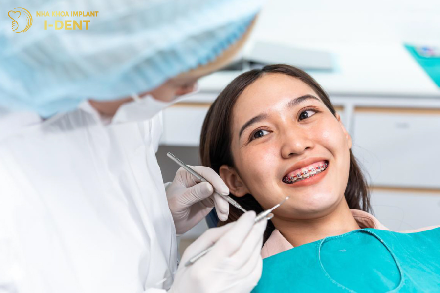 các loại niềng răng và chi phí