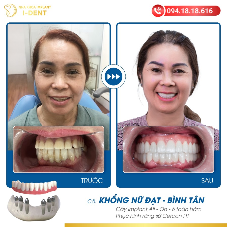 Khổng Nữ Đạt