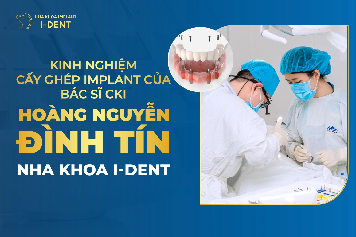 Kinh Nghiem Cay Ghep Implant Cua Bac Si