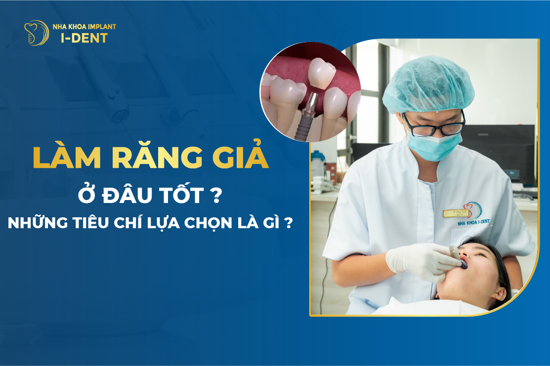Lam Rang Gia O Dau Tot Nhung Tieu Chi Lua Chon La Gi