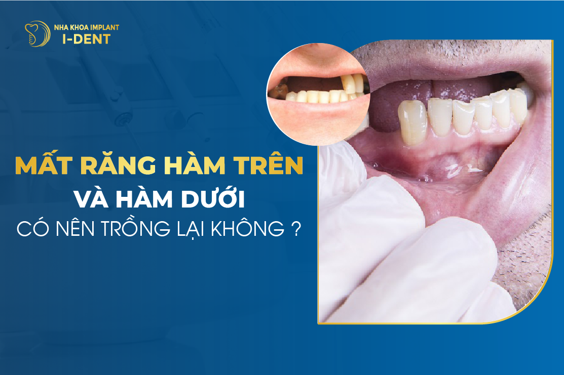 Mat Rang Ham Tren Va Ham Duoi Co Nen Trong Lai Khong