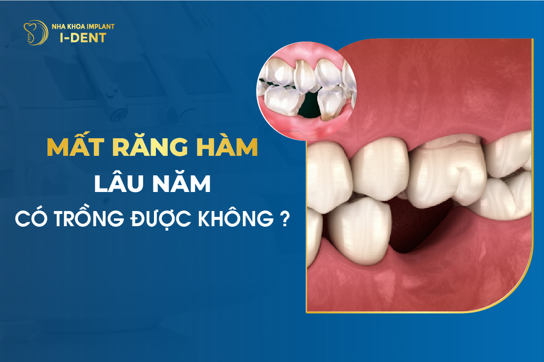 Mat Rang Ham Lau Nam Co Trong Duoc Khong