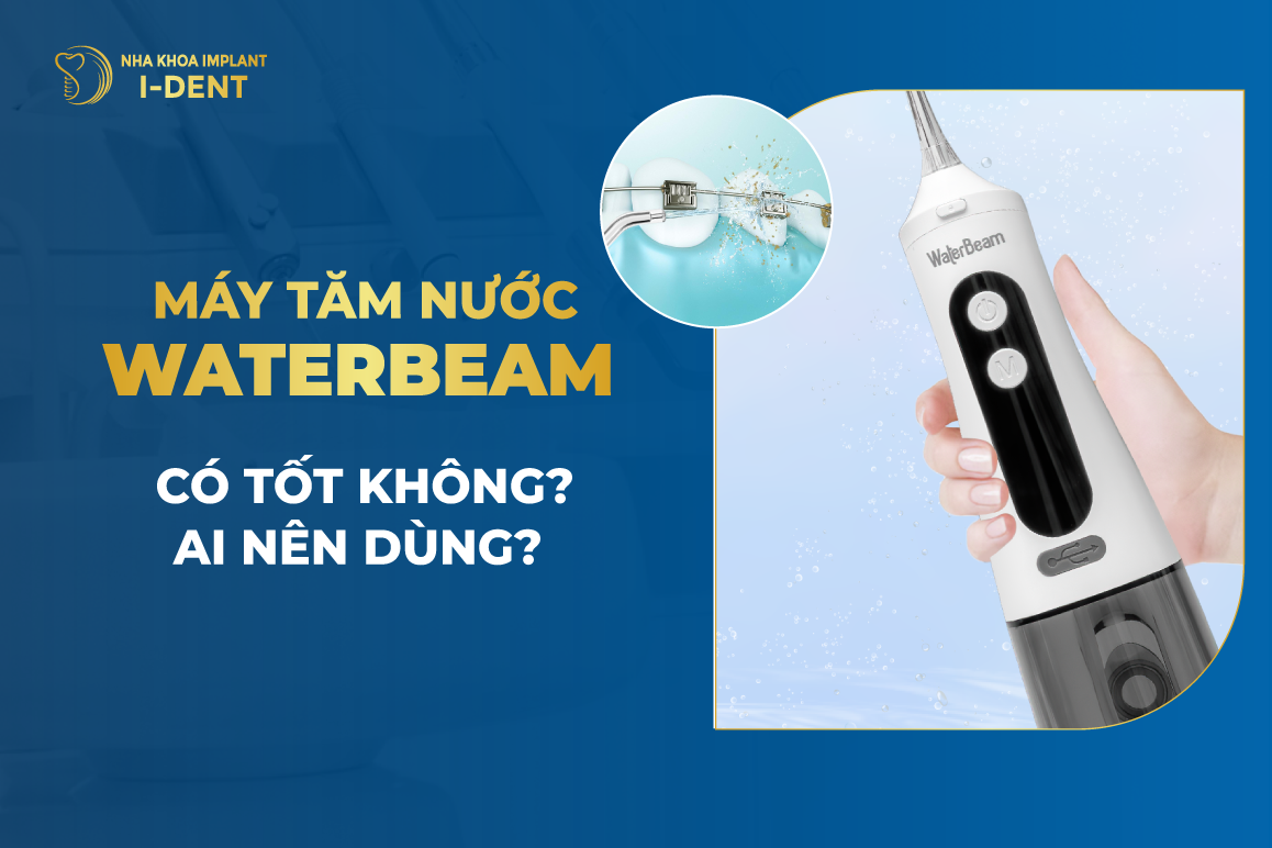 May Tam Nuoc Water Beam Co Tot Khong Ai Nen Dung