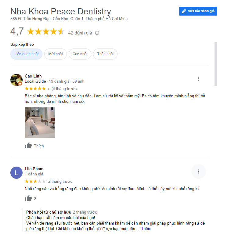 trong rang implant o dau tot nhat