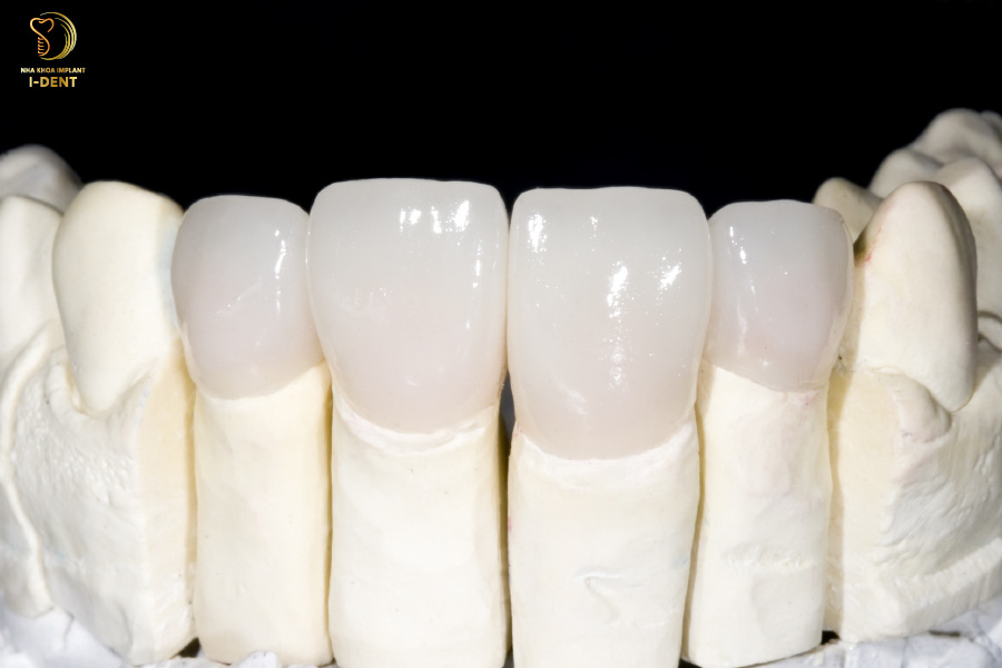 răng sứ zirconia giá rẻ