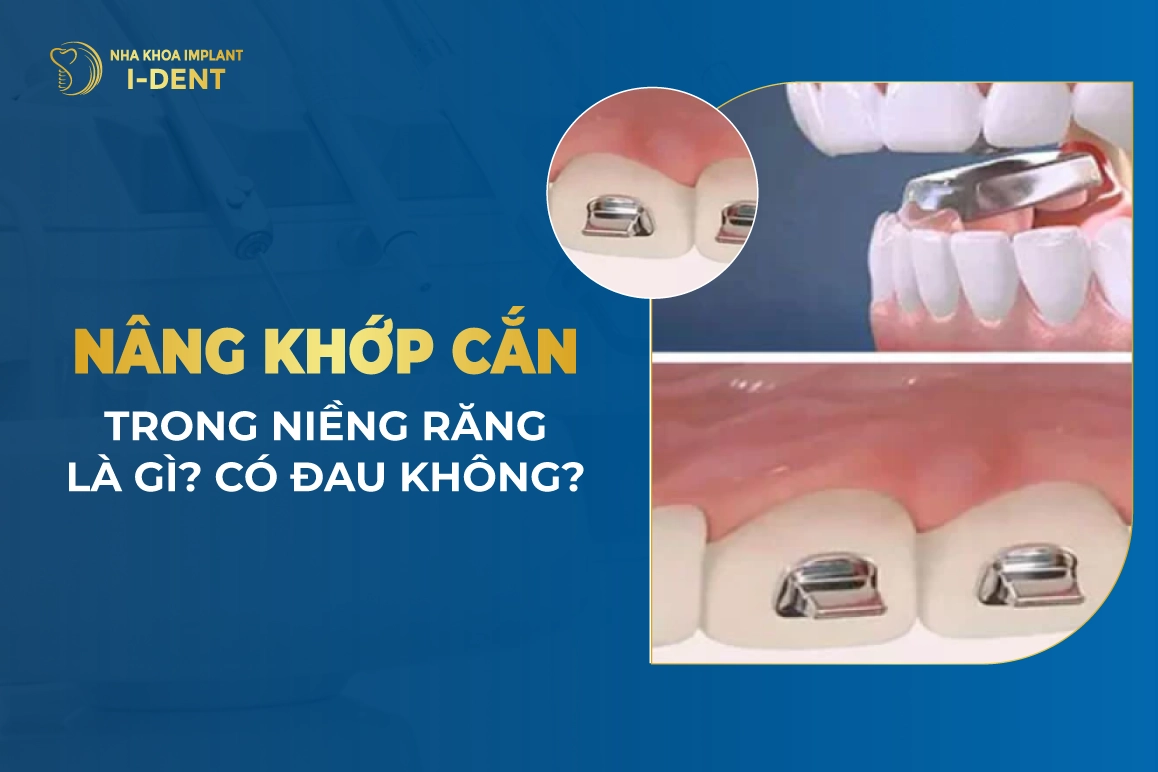 Nang Khop Can Trong Nieng Rang La Gi Co Dau Khong