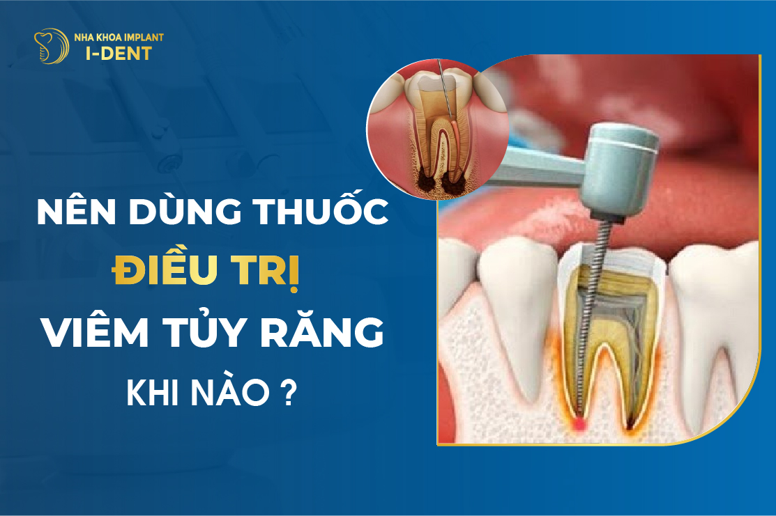 Nen Dung Thuoc Dieu Tri Viem Tuy Rang Khi Nao