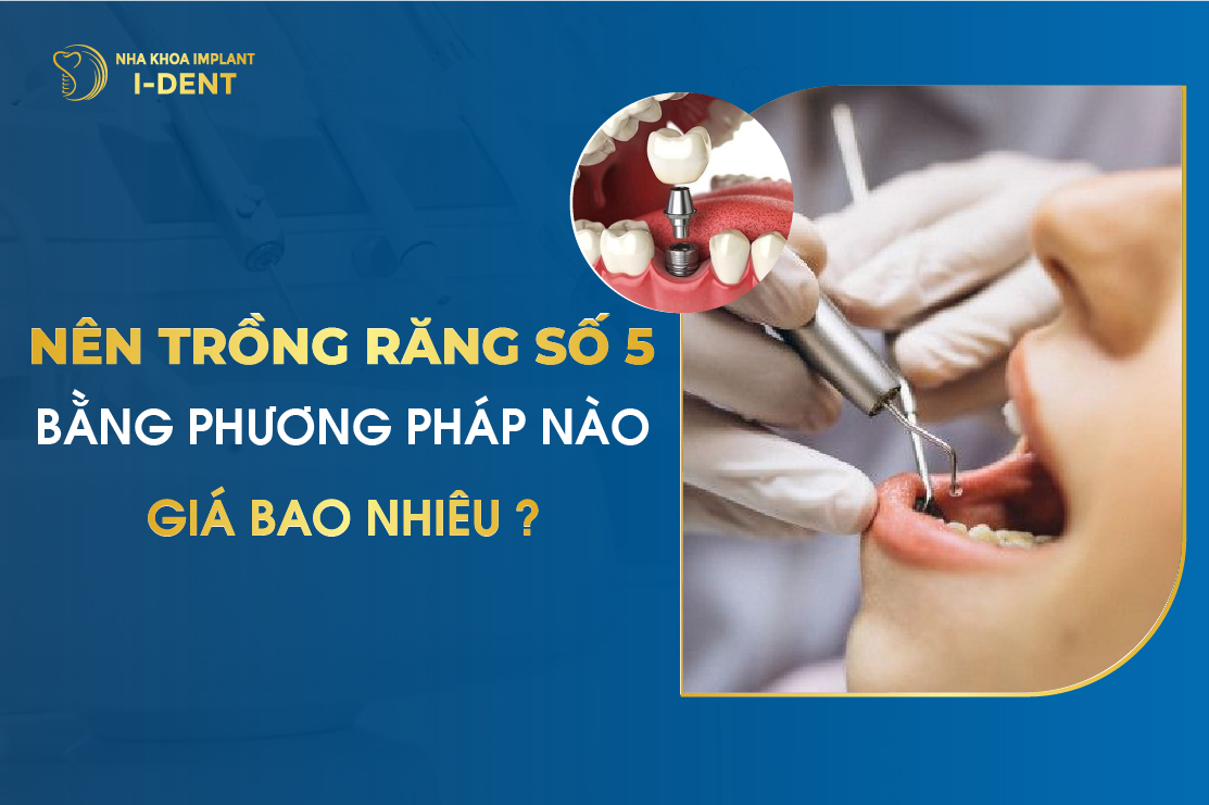 Nen Trong Rang So 5 Bang Phuong Phap Nao Va Gia Bao Nhieu