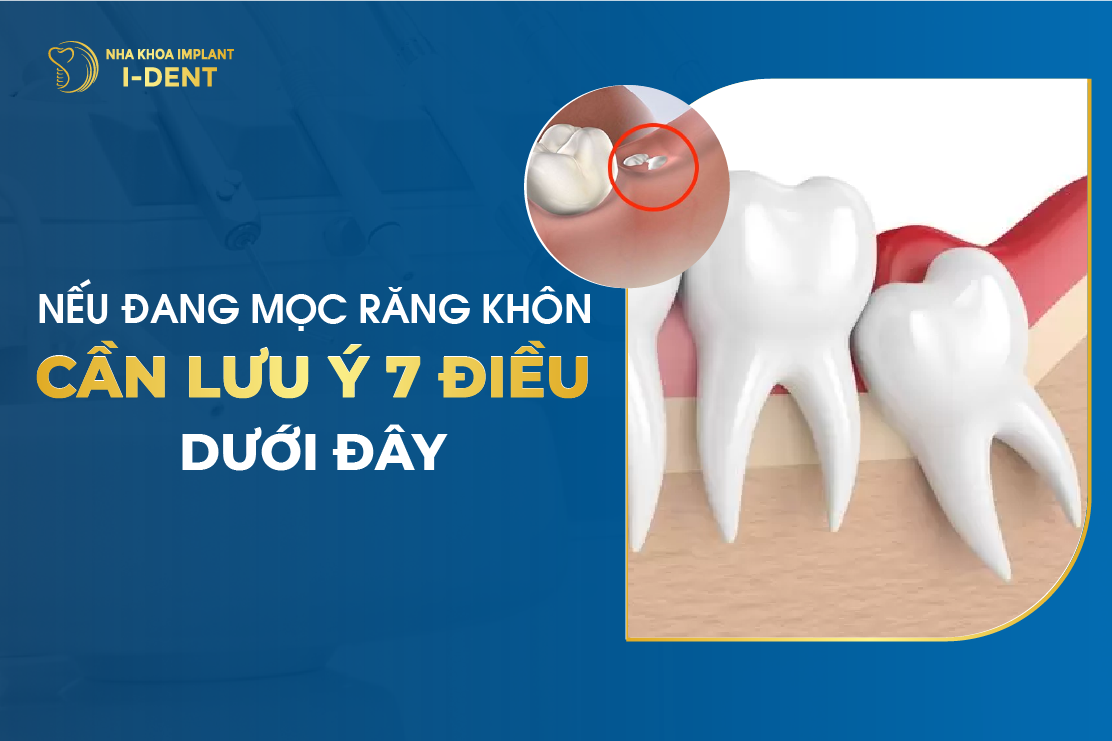 Neu Dang Moc Rang Khon Can Luu Y 7 Dieu Duoi Day