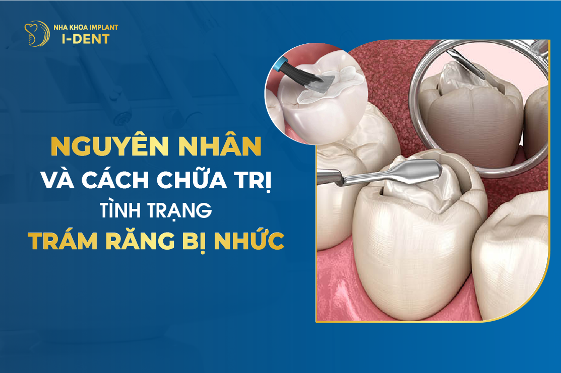 Nguyen Nhan Va Cach Chua Tri Tinh Trang Tram Rang Bi Nhuc