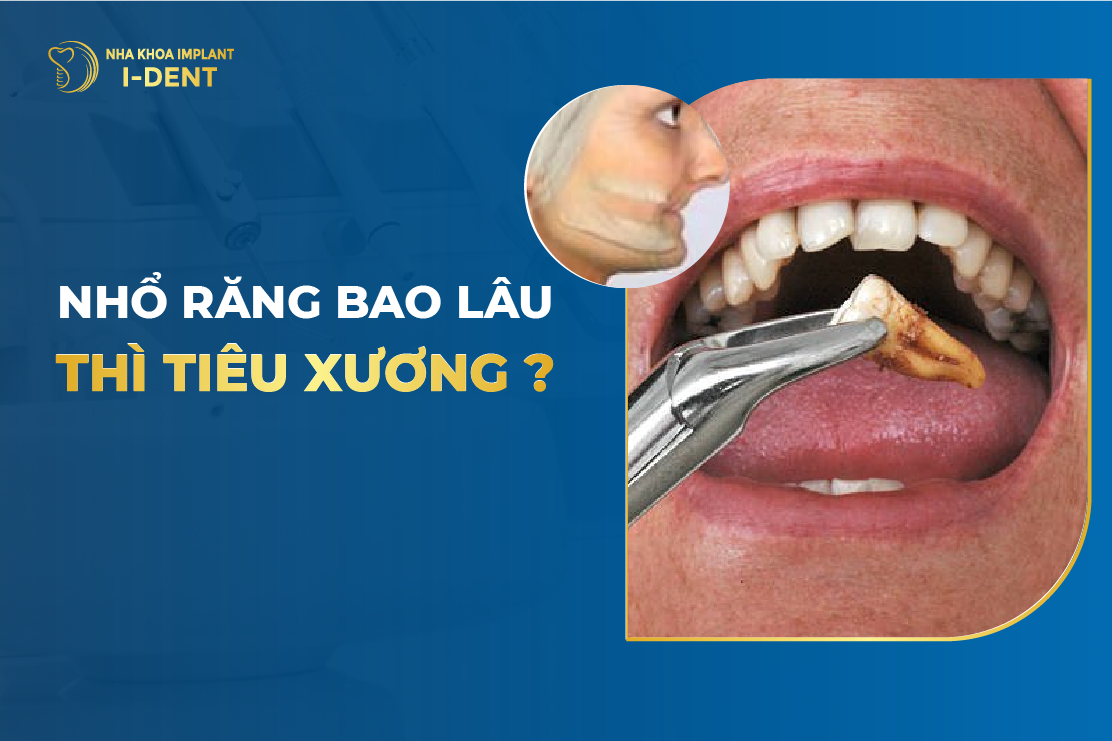 Nho Rang Bao Lau Thi Tieu Xuong