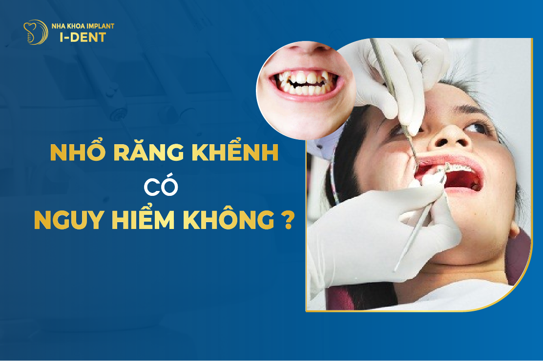 Nho Rang Khenh Co Nguy Hiem Khong