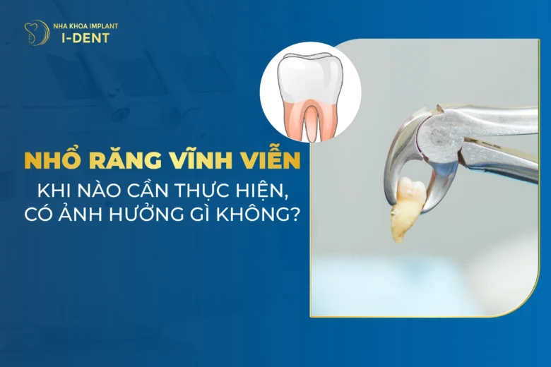 Nhổ Răng Vĩnh Viễn Có Ảnh Hưởng Gì Không? Quy Trình Nhổ?