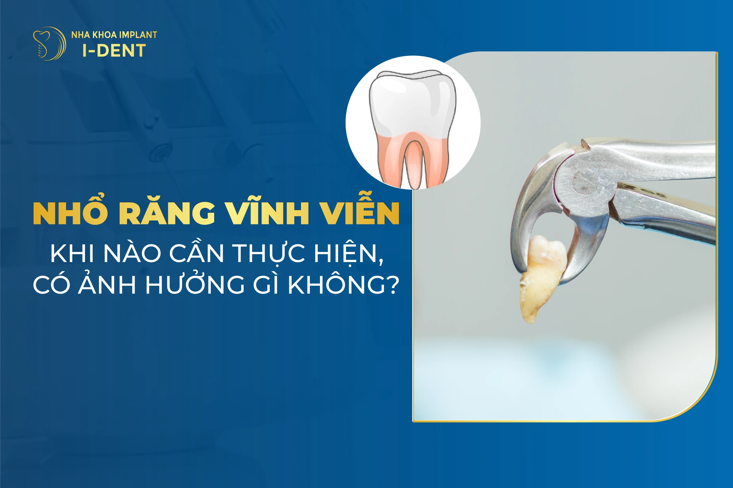Nho Rang Vinh Vien Co Anh Huong Gi Khong