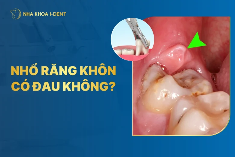 Nhổ Răng Khôn Có Đau Không? Những Lưu Ý Cần Biết