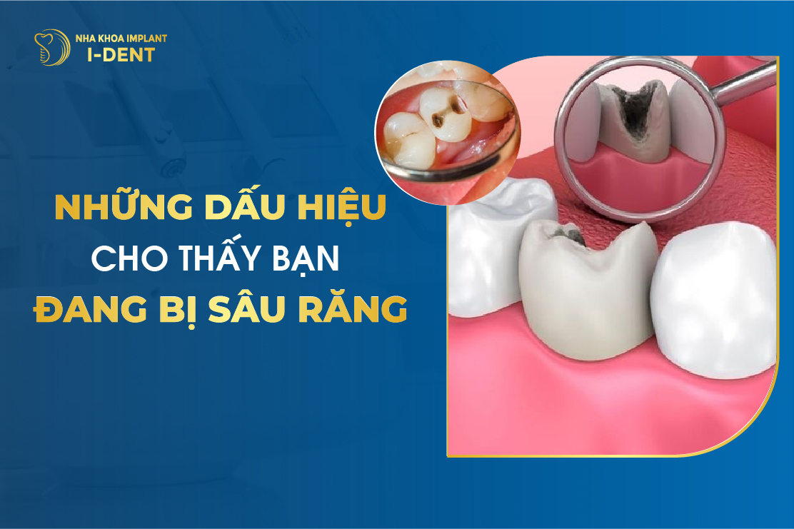 Nhung Dau Hieu Cho Thay Ban Dang Bi Sau Rang