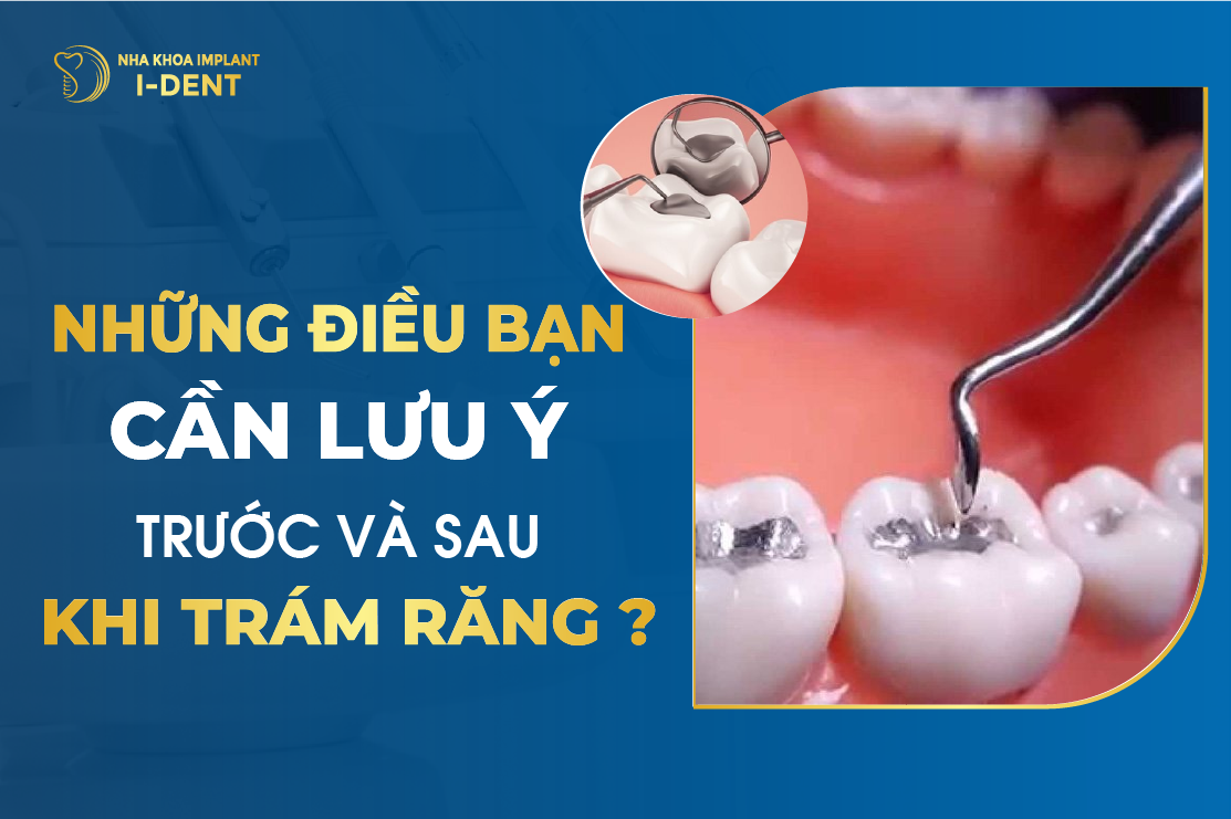 Nhung Dieu Ban Can Luu Y Truoc Va Sau Khi Tram Rang
