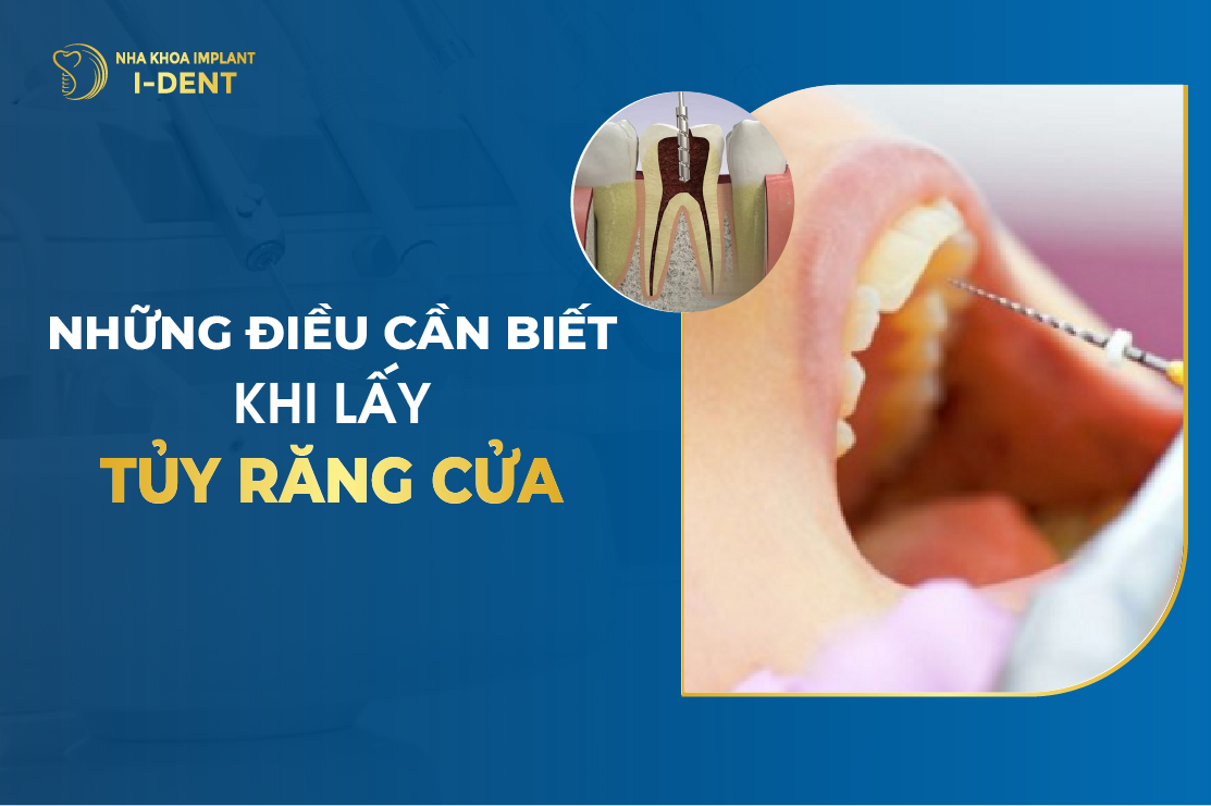 Nhung Dieu Can Biet Khi Lay Tuy Rang Cua