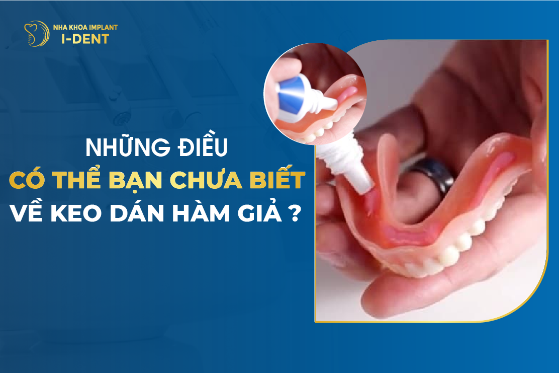 Nhung Dieu Co The Ban Chua Biet Ve Keo Dan Ham Gia