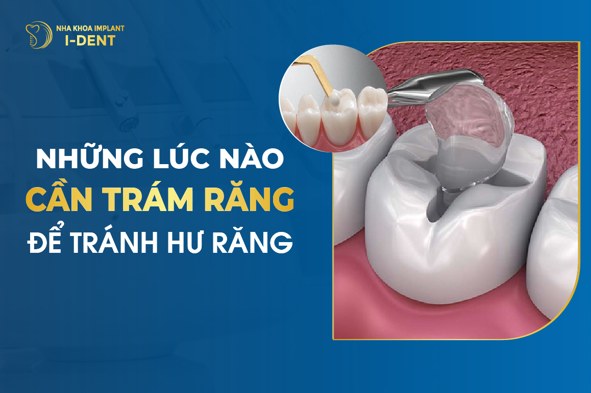 Nhung Luc Nao Can Phai Tram Rang De Tranh Hu Rang