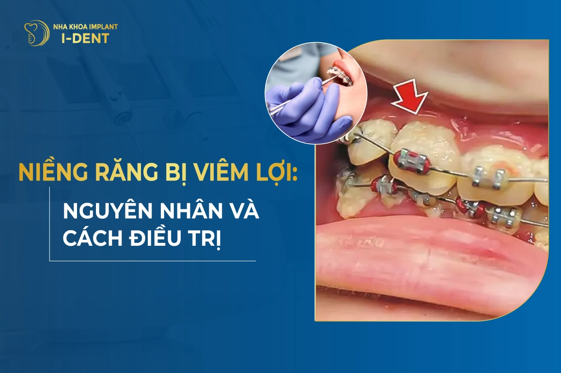 Nieng Rang Bi Viem Loi Nguyen Nhan Va Cach Dieu Tri