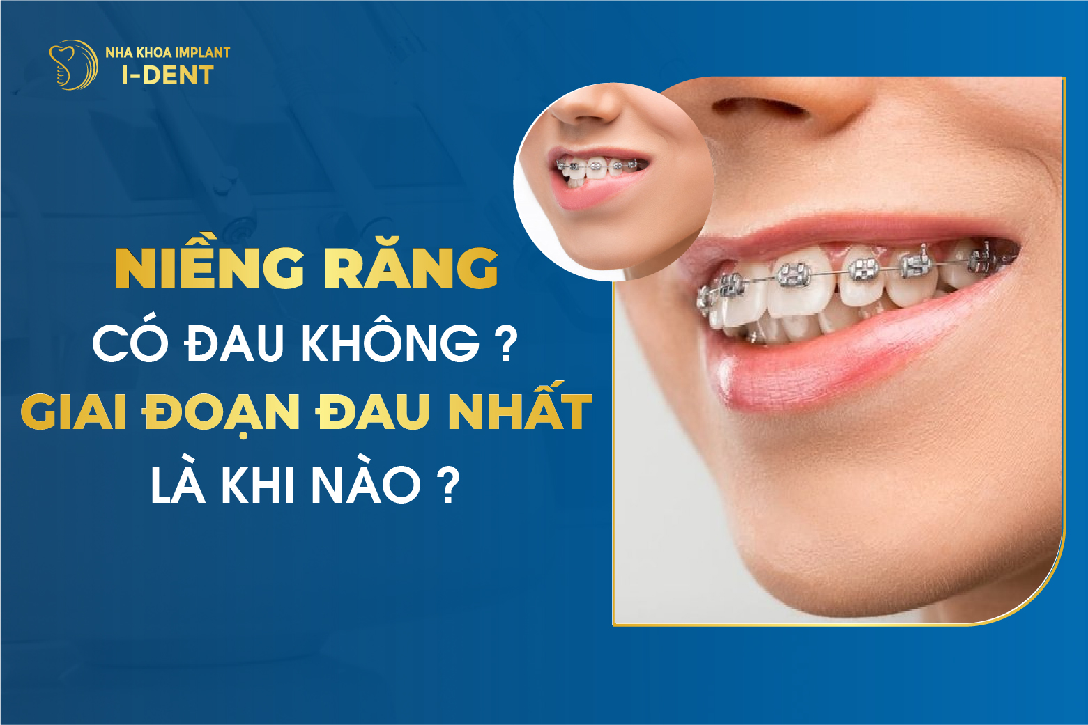 Nieng Rang Co Dau Khong Giai Doan Dau Nhat La Khi Nao