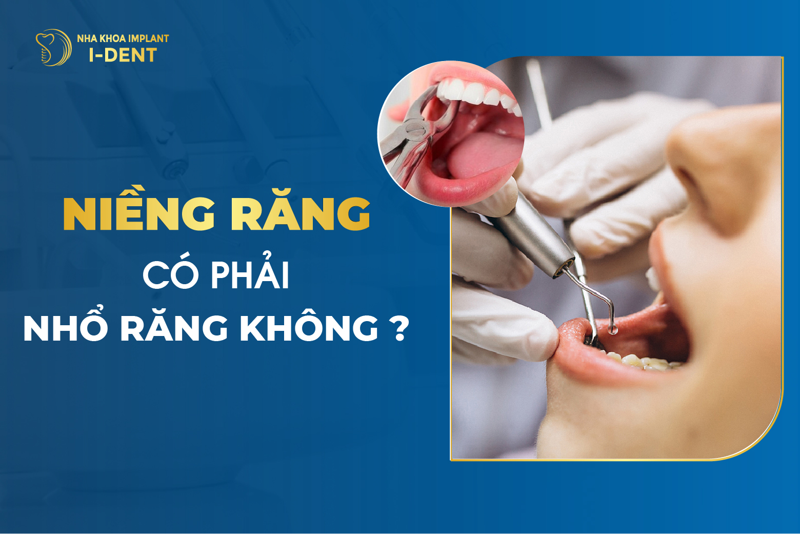 Nieng Rang Co Phai Nho Rang Khong