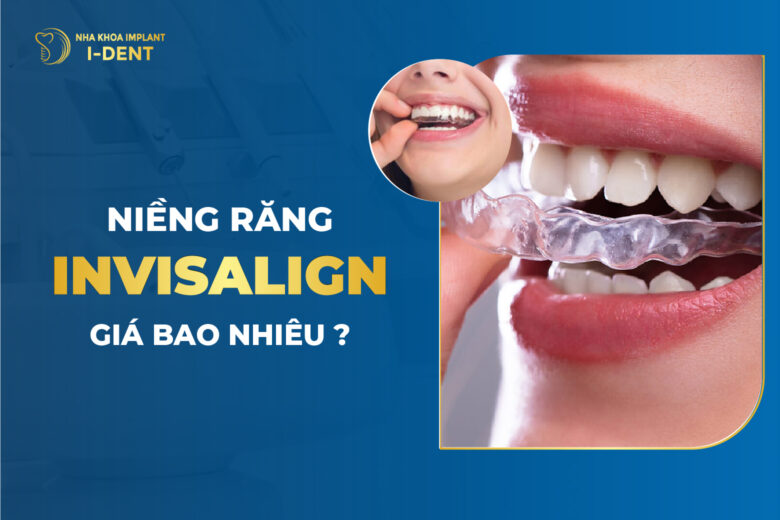 Giá Niềng Răng Invisalign Bao Nhiêu? Chi Phí T3/2026