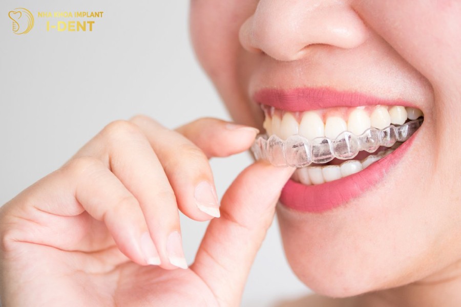 niềng răng tháo lắp có hiệu quả không