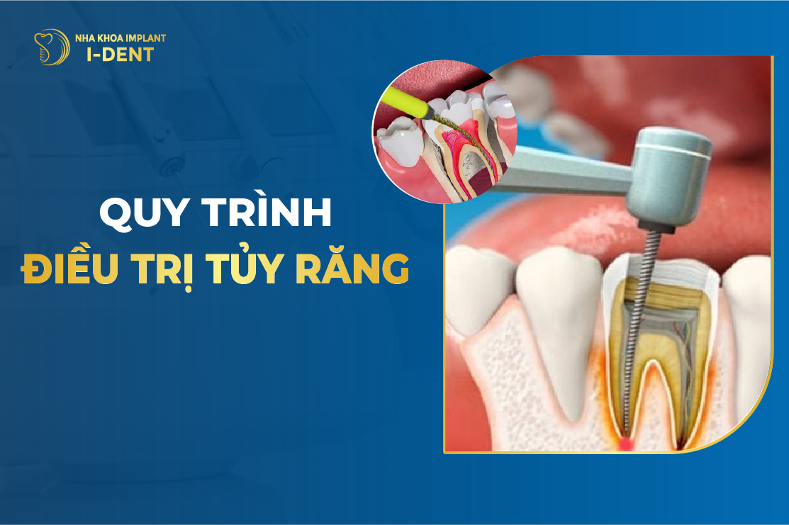 Quy Trinh Dieu Tri Tuy Rang