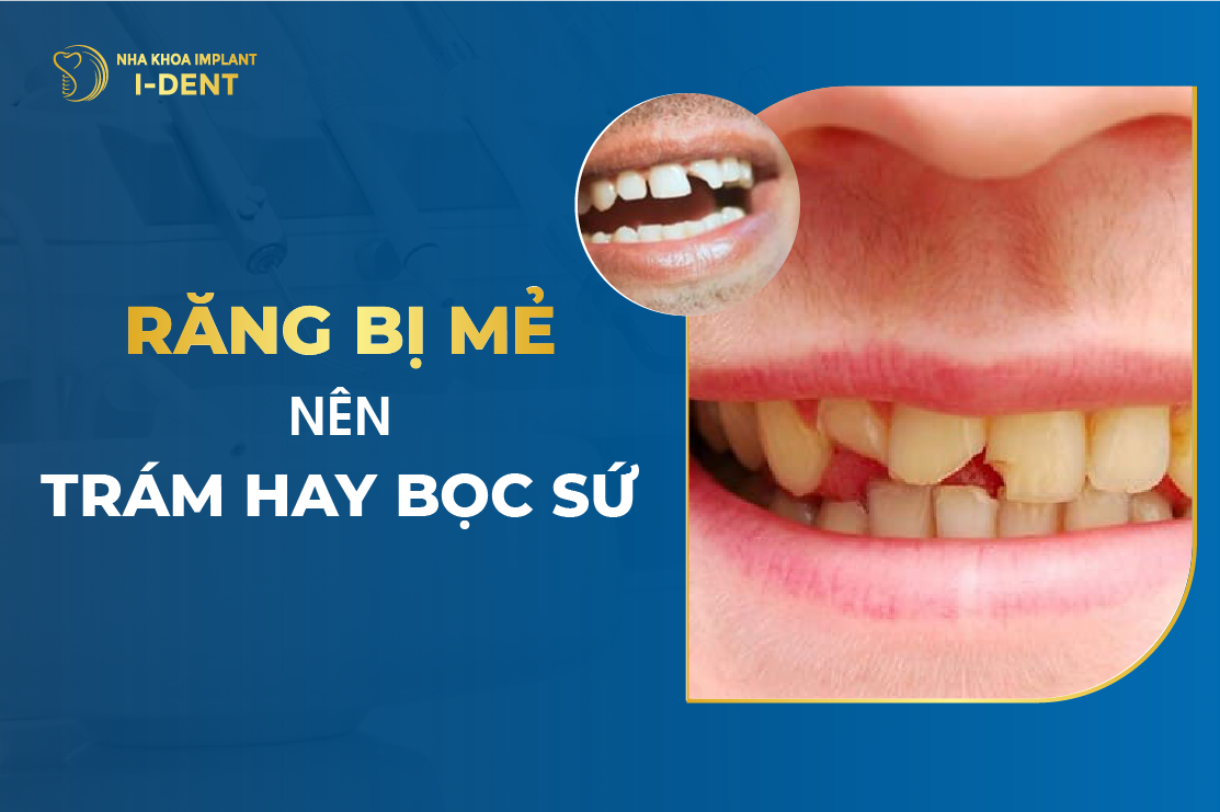 Rang Bi Me Nen Tram Hay Boc Su