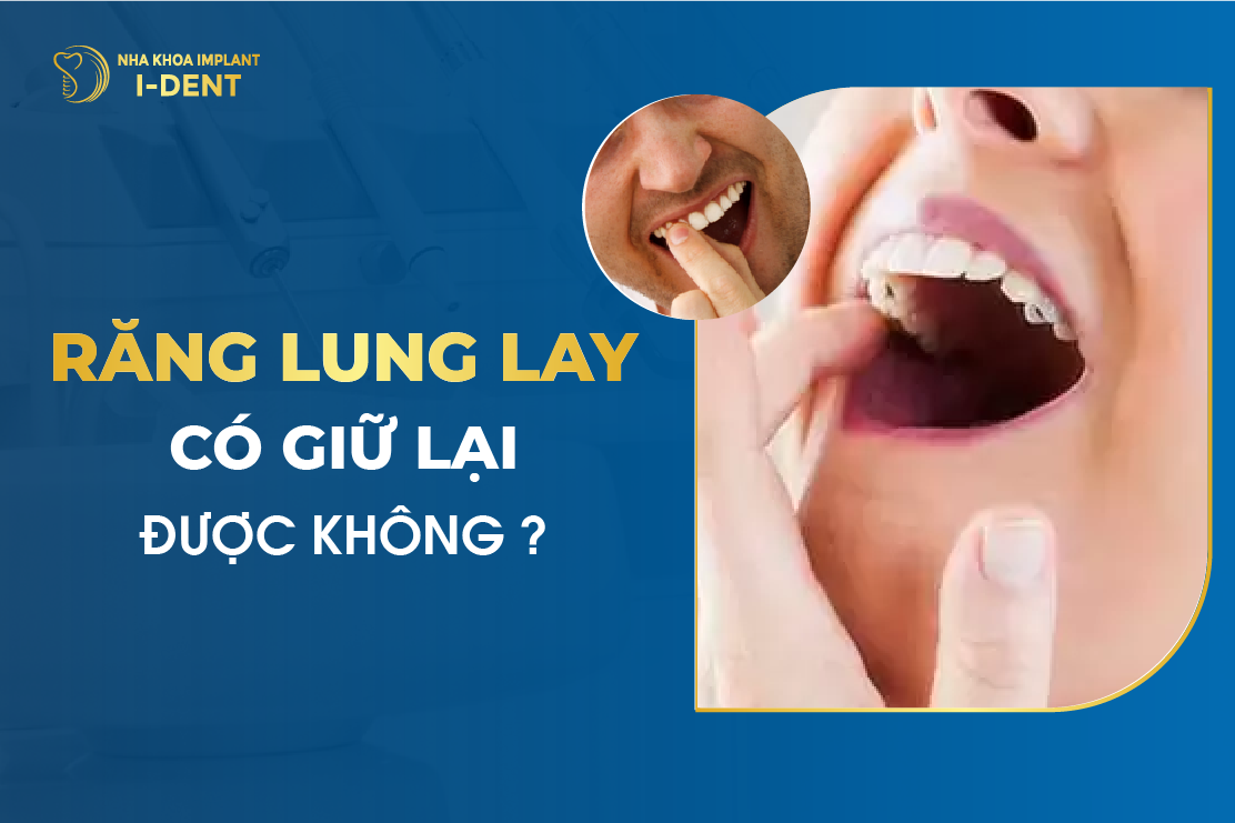 Rang Lung Lay Co Giu Lai Duoc Khong