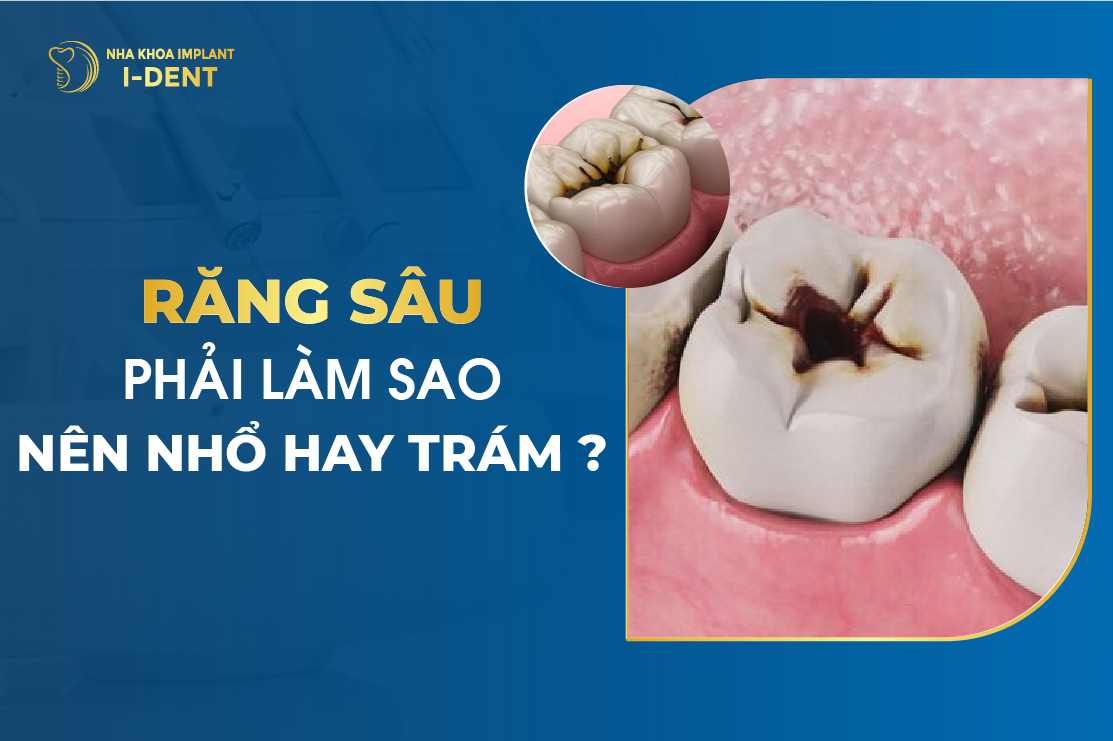 Rang Sau Phai Lam Sao – Nen Nho Hay Tram