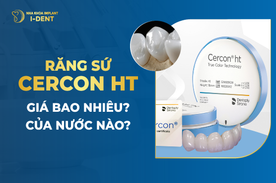 Răng Sứ Cercon Ht Giá Bao Nhiêu? Của Nước Nào?