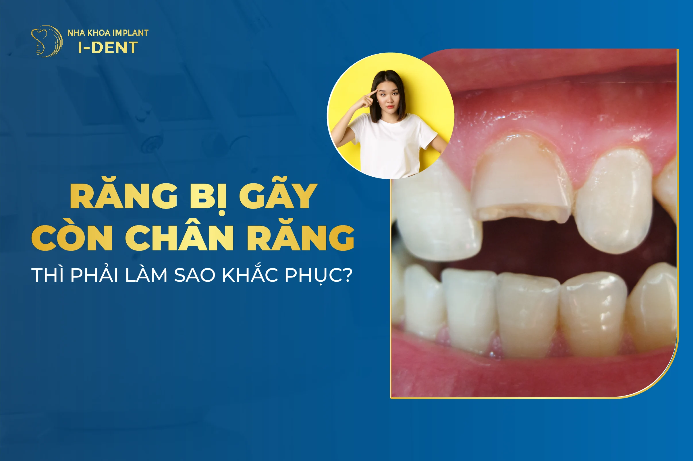 Rang Bi Gay Con Chan Rang Thi Phai Lam Sao Khac Phuc