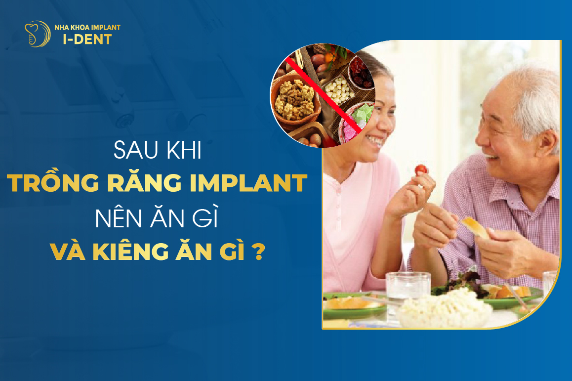 Sau Khi Trong Rang Implant Nen An Gi Va Kieng An Gi 1