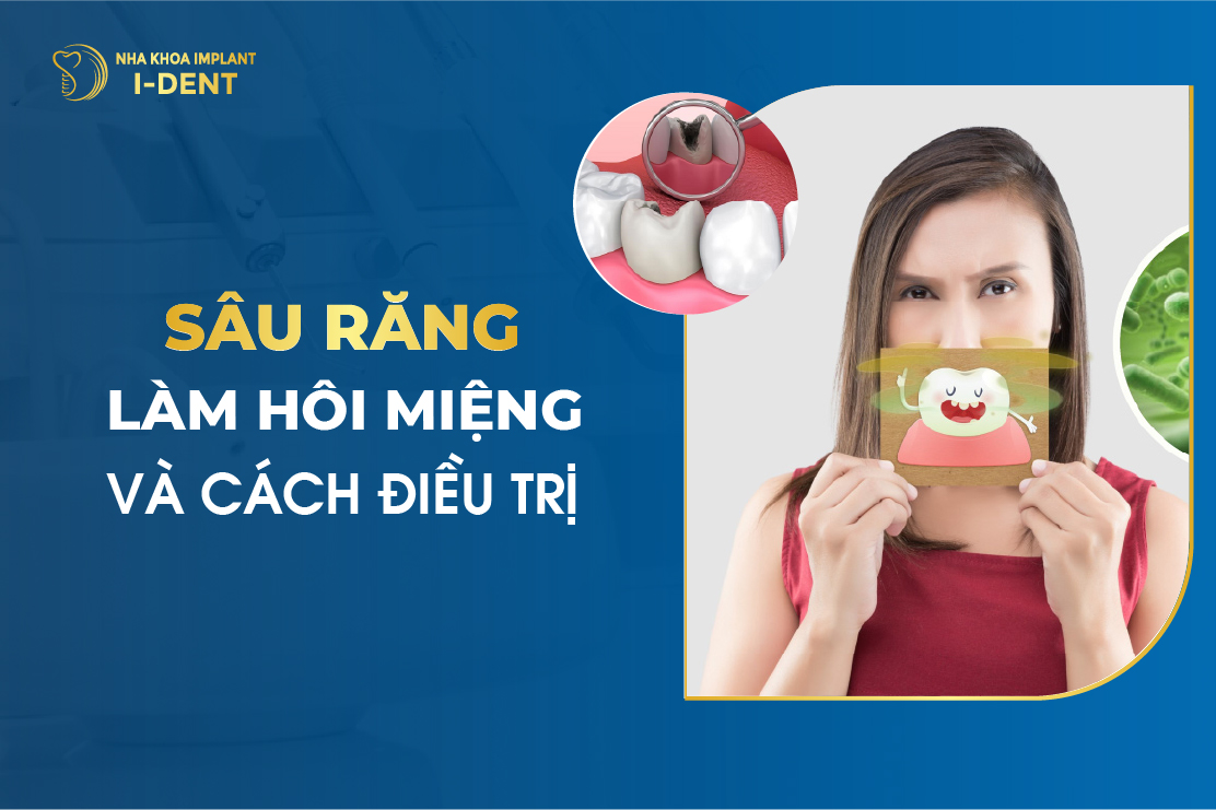 Sau Rang Lam Hoi Mieng Va Cach Dieu Tri