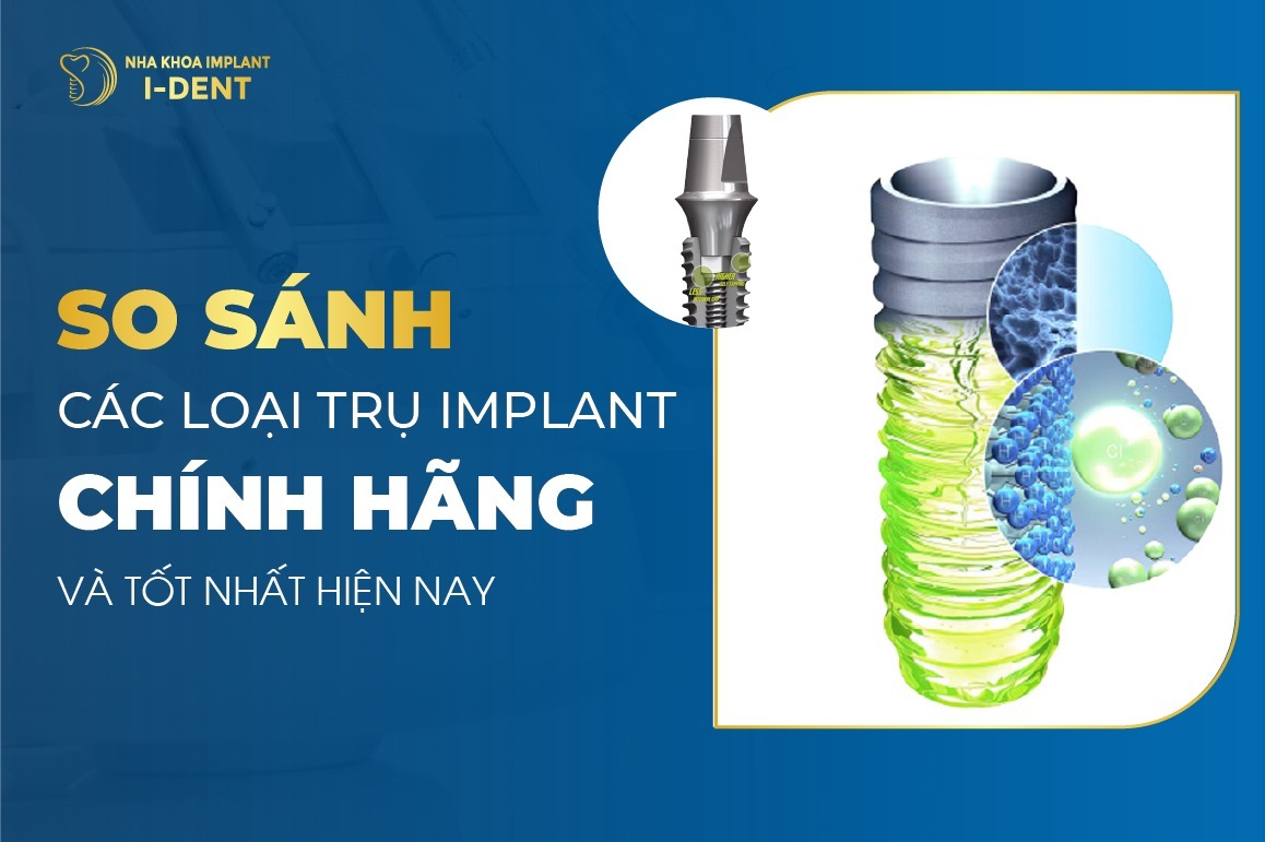 So Sanh Cac Loai Tru Implant Chinh Hang Tot Hien Nay