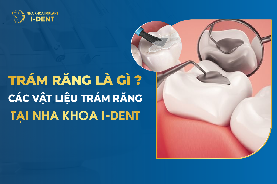 Tram Rang Co Dau Khong Quy Trinh Tram Rang Tai I Dent