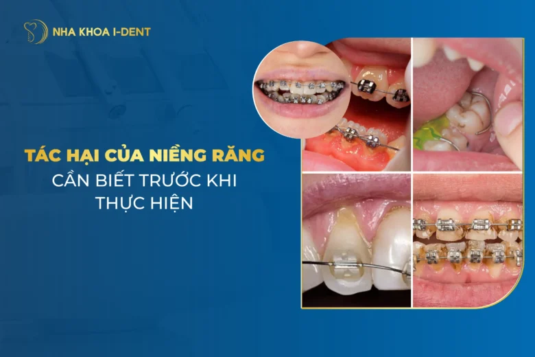 Những Tác Hại Của Niềng Răng Khi Về Già Tại Nha Khoa Kém Chất Lượng
