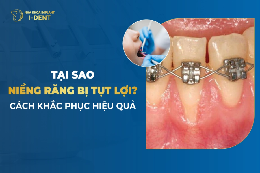 Tai Sao Nieng Rang Bi Tut Loi Cach Khac Phuc Hieu Qua E1763459721532