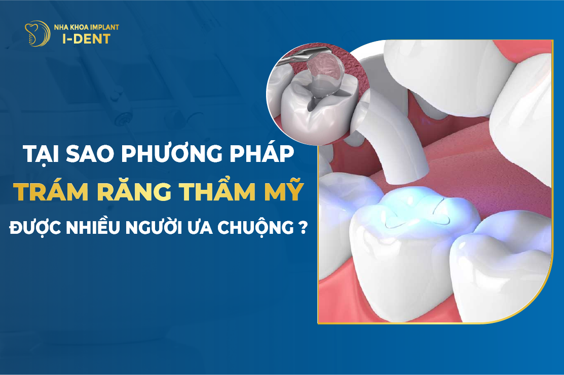Tai Sao Phuong Phap Tram Rang Tham My Duoc Nhieu Nguoi Ua Chuong 1