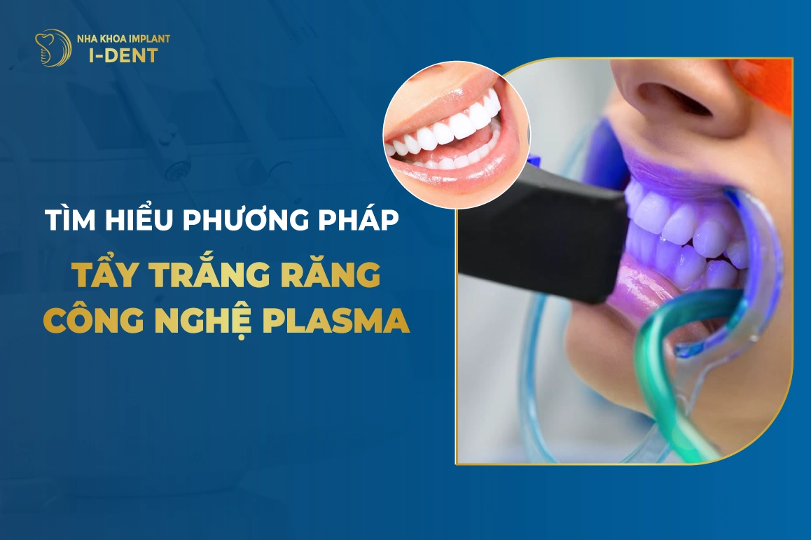 Tay Trang Rang Cong Nghe Plasma