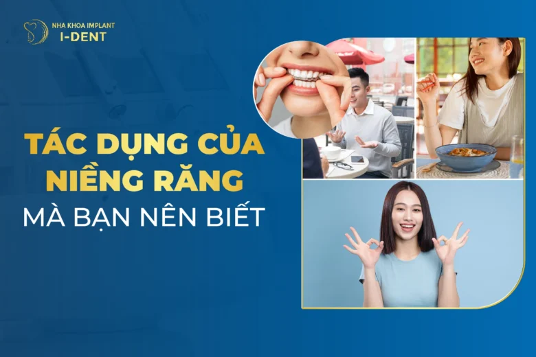 Niềng Răng Có Tác Dụng Gì? Lợi Ích Khi Niềng Răng
