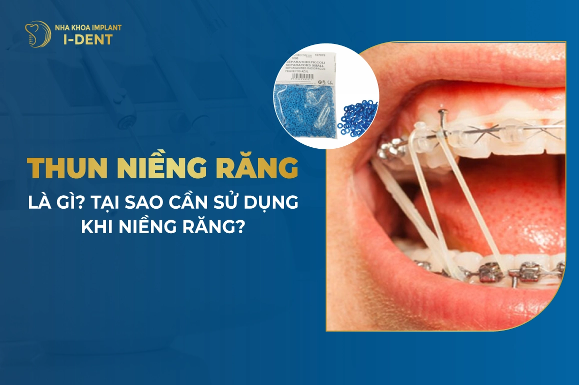 Thun Nieng Rang La Gi Tai Sao Can Su Dung Khi Nieng Rang