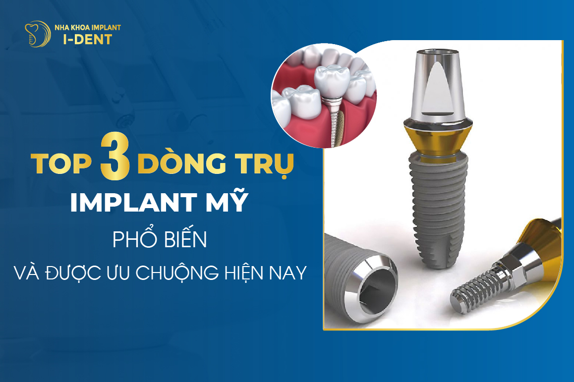 Top 3 Dong Tru Implant My Pho Bien Va Duoc Ua Chuong Hien Nay 1